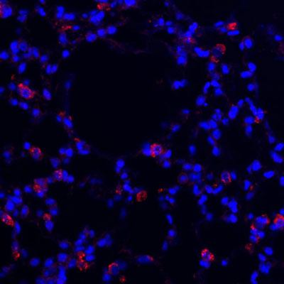 Anti-Prosurfactant Protein C (proSP-C) Antibody